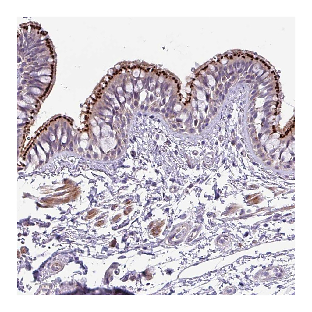 Atlas Antibodies Anti-SPINK8 Antibody