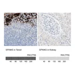 Atlas Antibodies Anti-SPINK5 Antibody