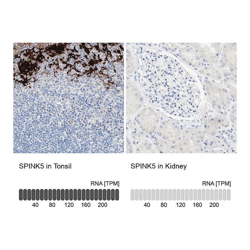 Atlas Antibodies Anti-SPINK5 Antibody