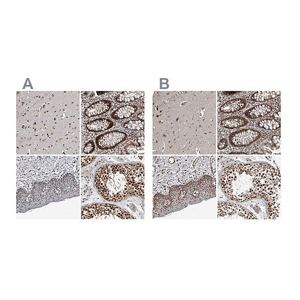 Merck Anti-CHD1L antibody produced in rabbit