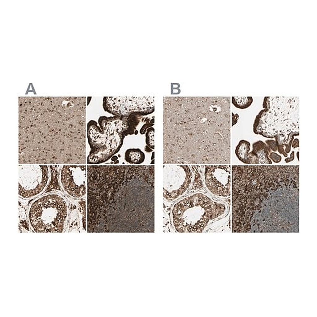Merck Anti-CANX antibody produced in rabbit