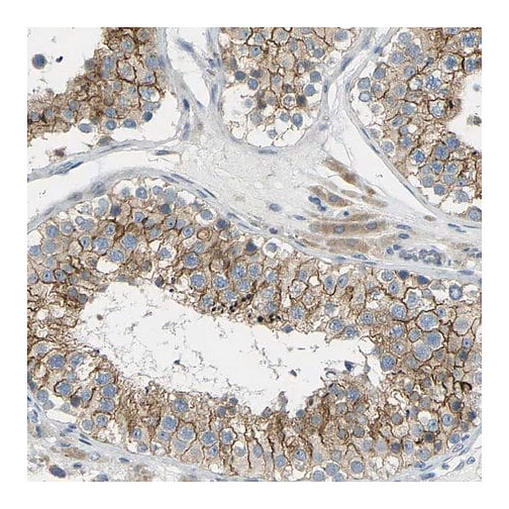 Merck Anti-RHBDD1 antibody produced in rabbit