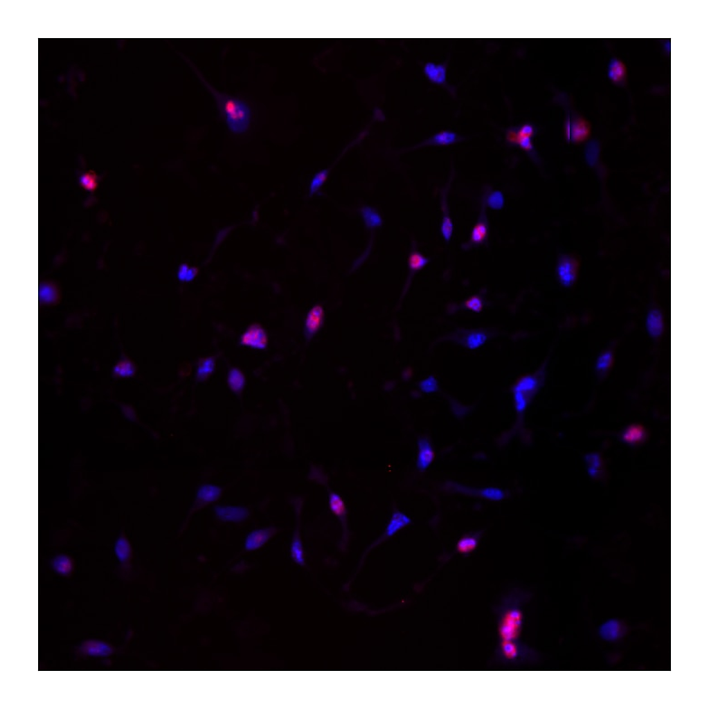 BD Alexa Fluor® 647 Mouse anti-Cleaved PARP (Asp 214)