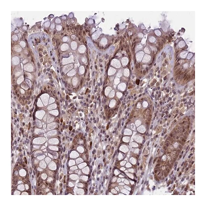 Merck Anti-RBBP8 antibody produced in rabbit