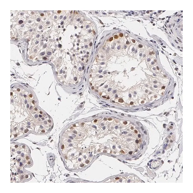 Merck Anti-ZBTB16 antibody produced in rabbit
