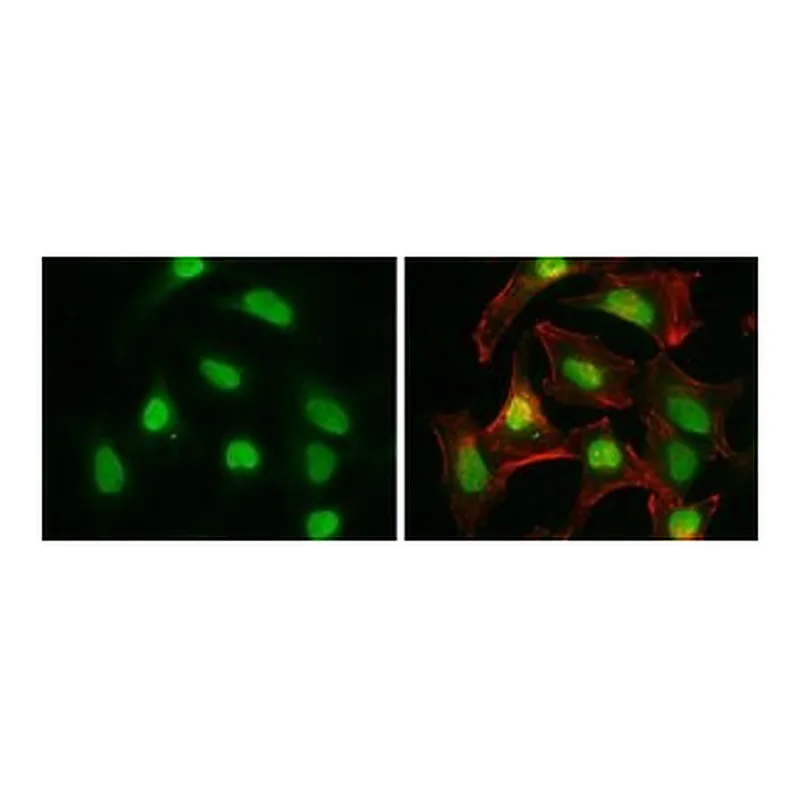 Merck MONOCLONAL ANTI-RBBP8