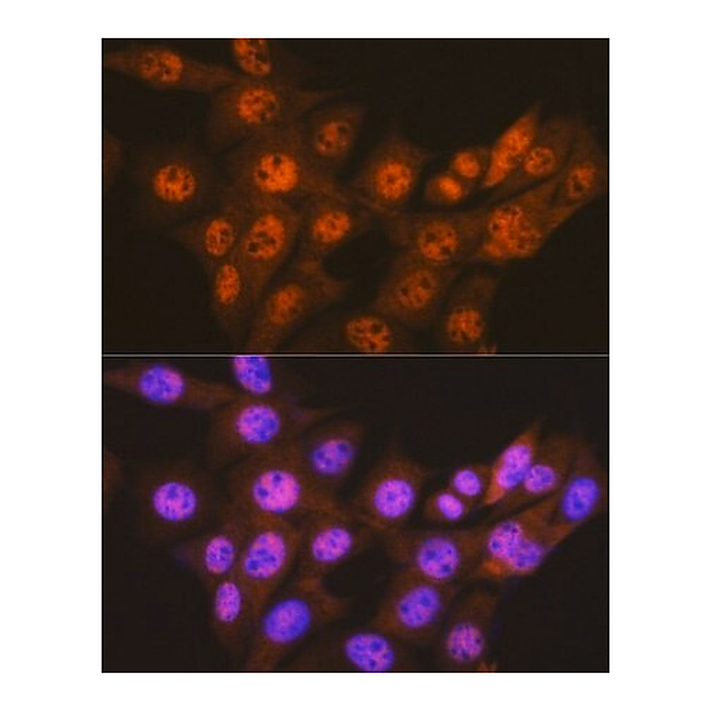 Merck Anti-PSMA1 antibody produced in rabbit