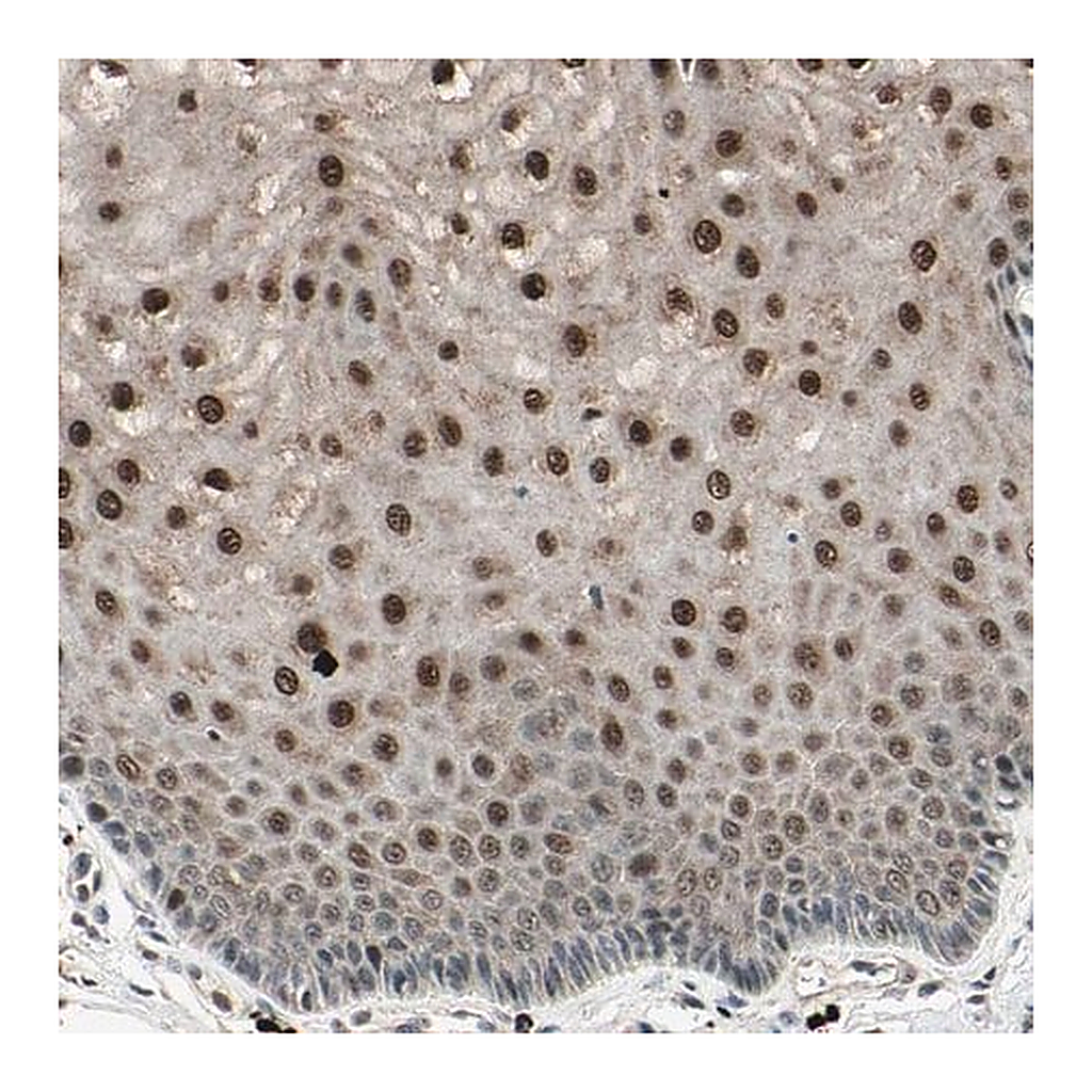 Merck Anti-NUAK2 antibody produced in rabbit