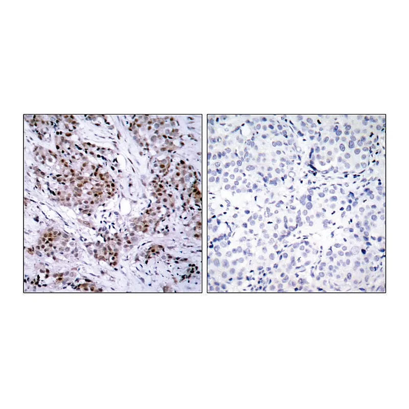 Merck Anti-Estrogen Receptor-alpha antibody produced in rabbit