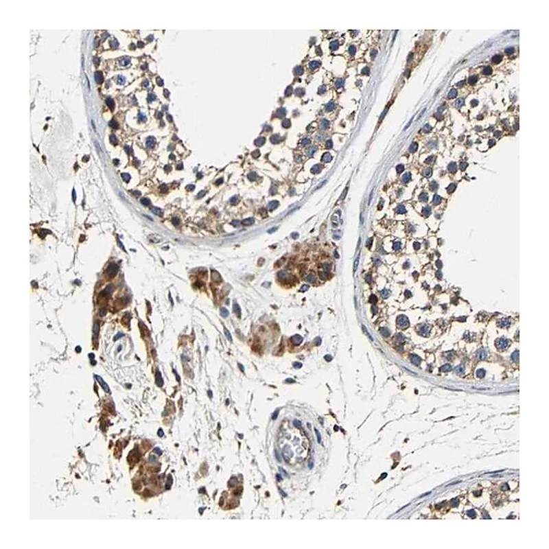 Merck Anti-MTX1 antibody produced in rabbit
