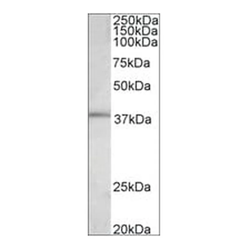 Merck ANTI-FOS