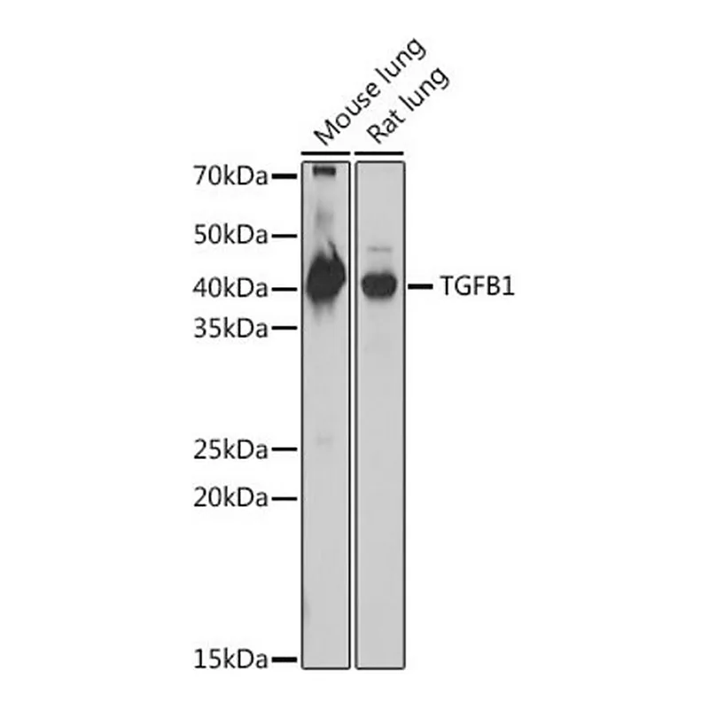 Merck Anti- TGFB1 antibody produced in rabbit