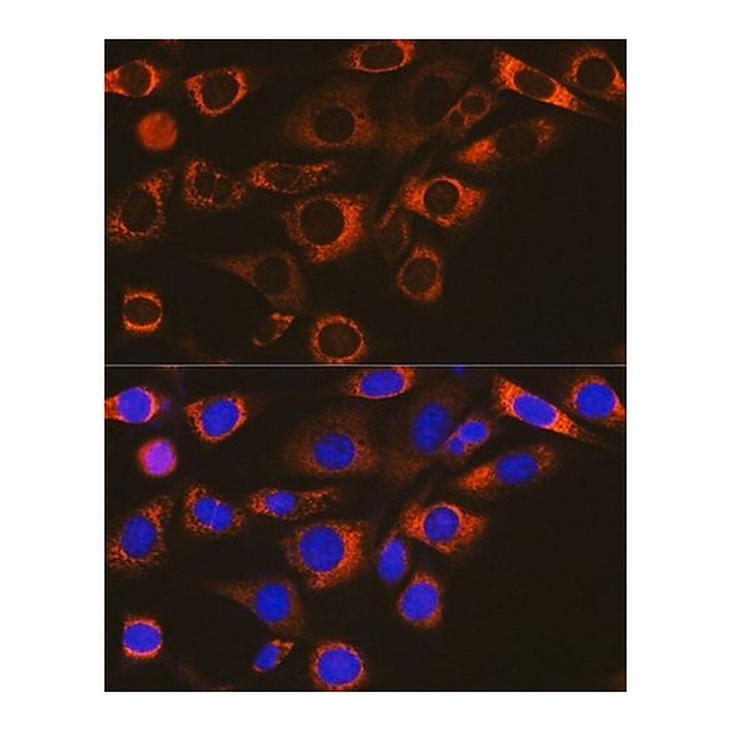 Merck Anti-FAAH1 antibody produced in rabbit