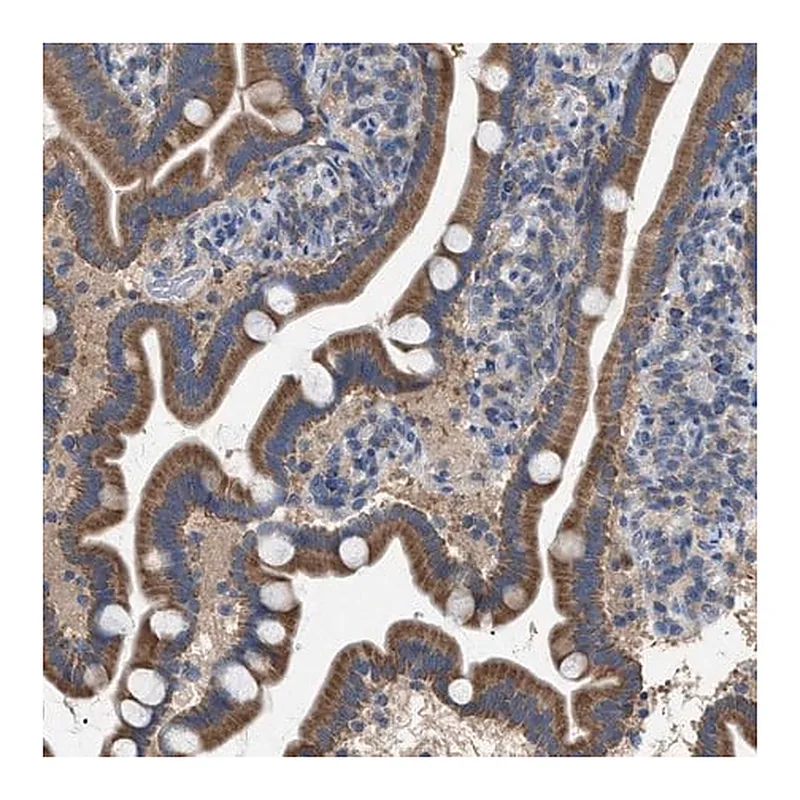 Merck Anti-VPS13A antibody produced in rabbit