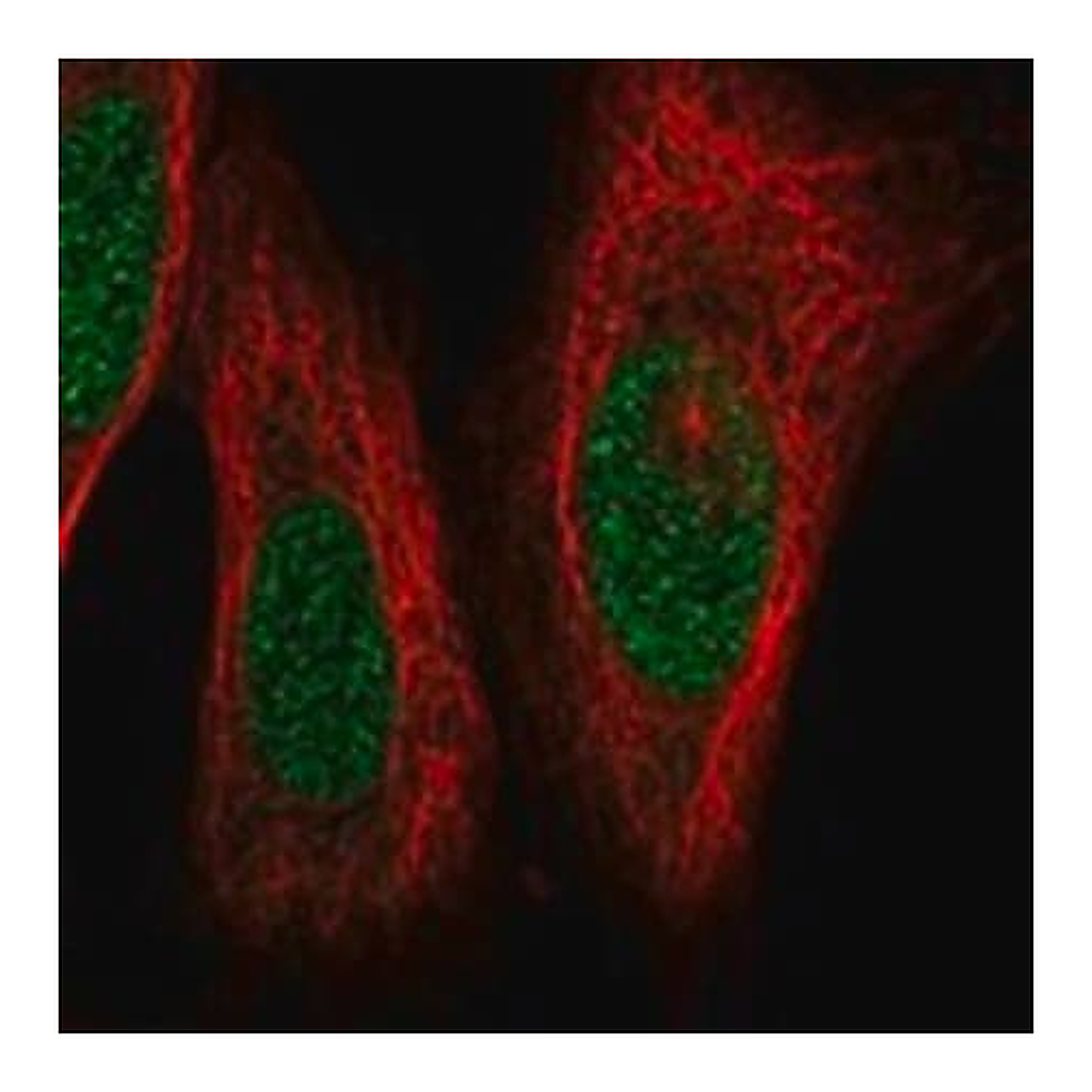 Merck Anti-LHX1 antibody produced in rabbit