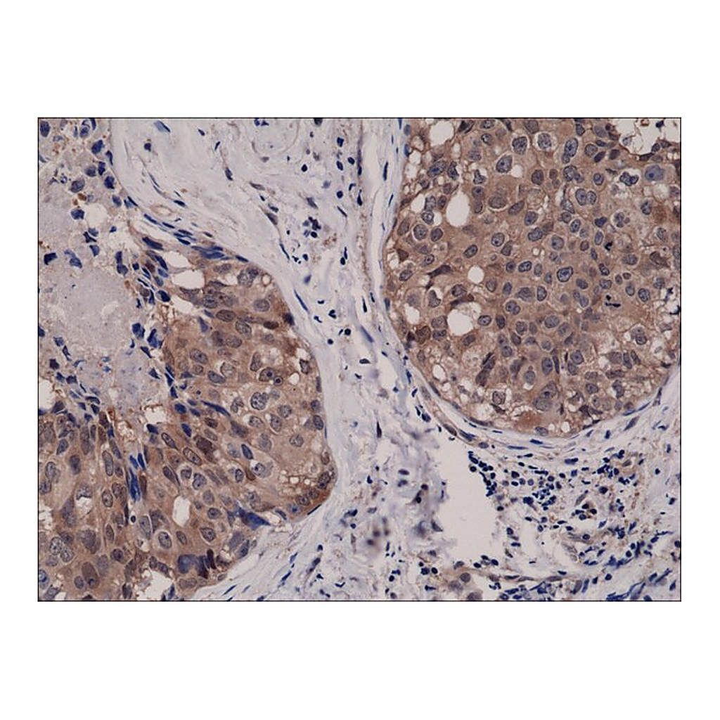 Merck Anti-AKT1 antibody, Rabbit monoclonal