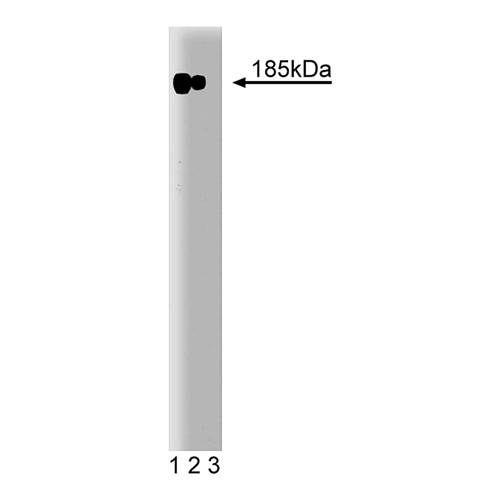 BD Purified Mouse Anti-Human ErbB2