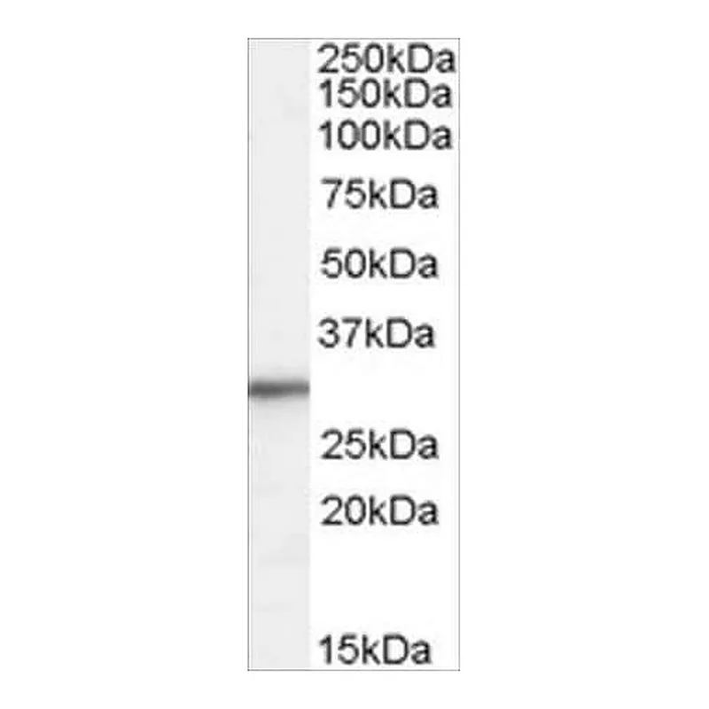 Merck Anti-Ribosomal Protein L8 antibody produced in goat