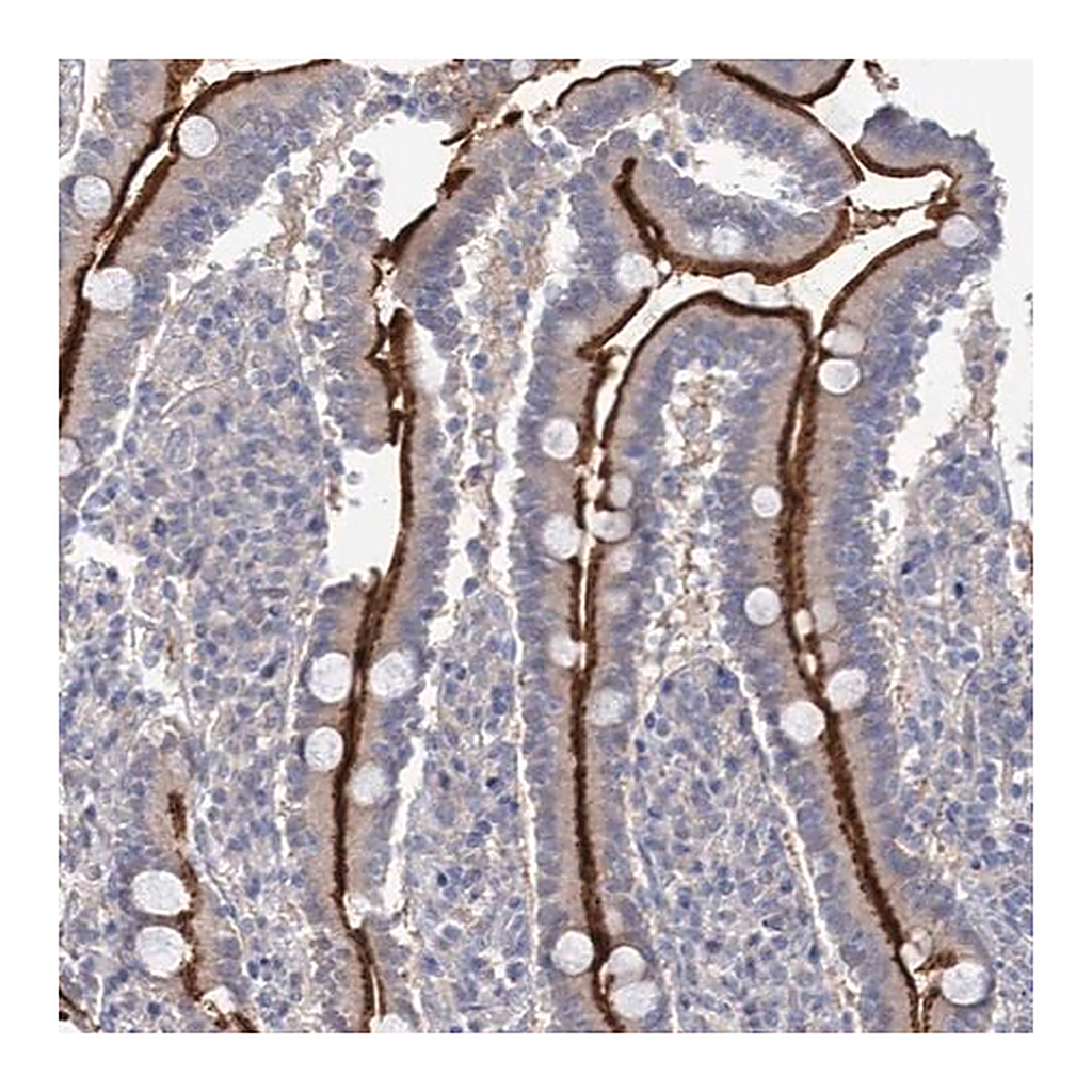 Merck Anti-NEK10 antibody produced in rabbit