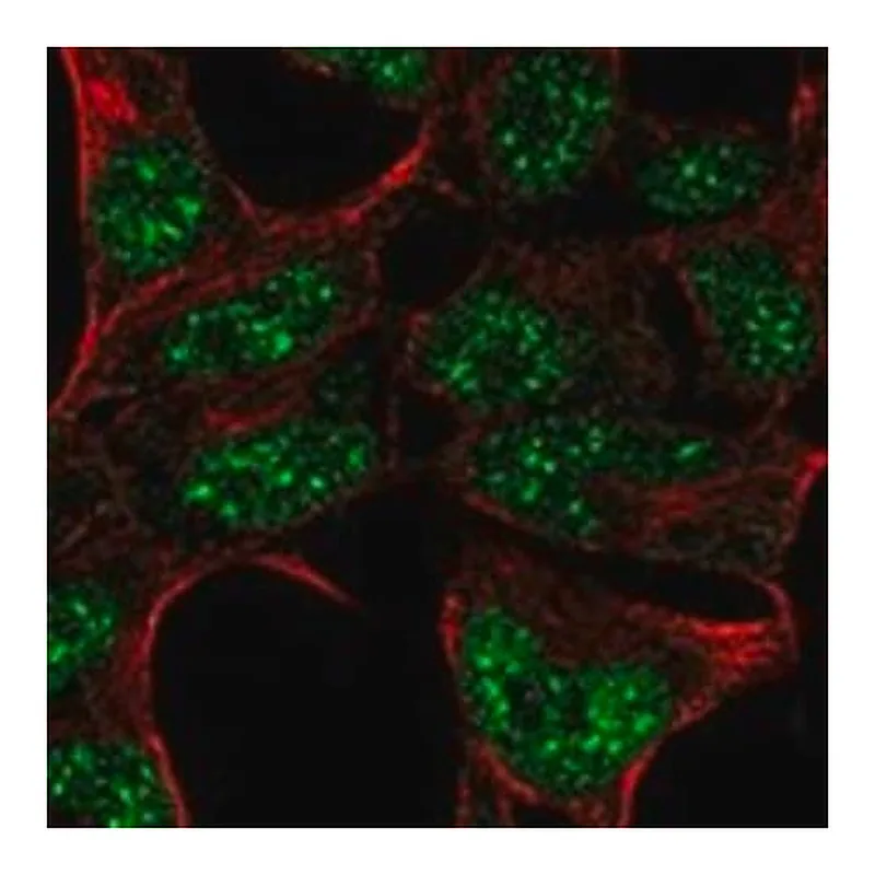 Merck Anti-HOXA6 antibody produced in rabbit