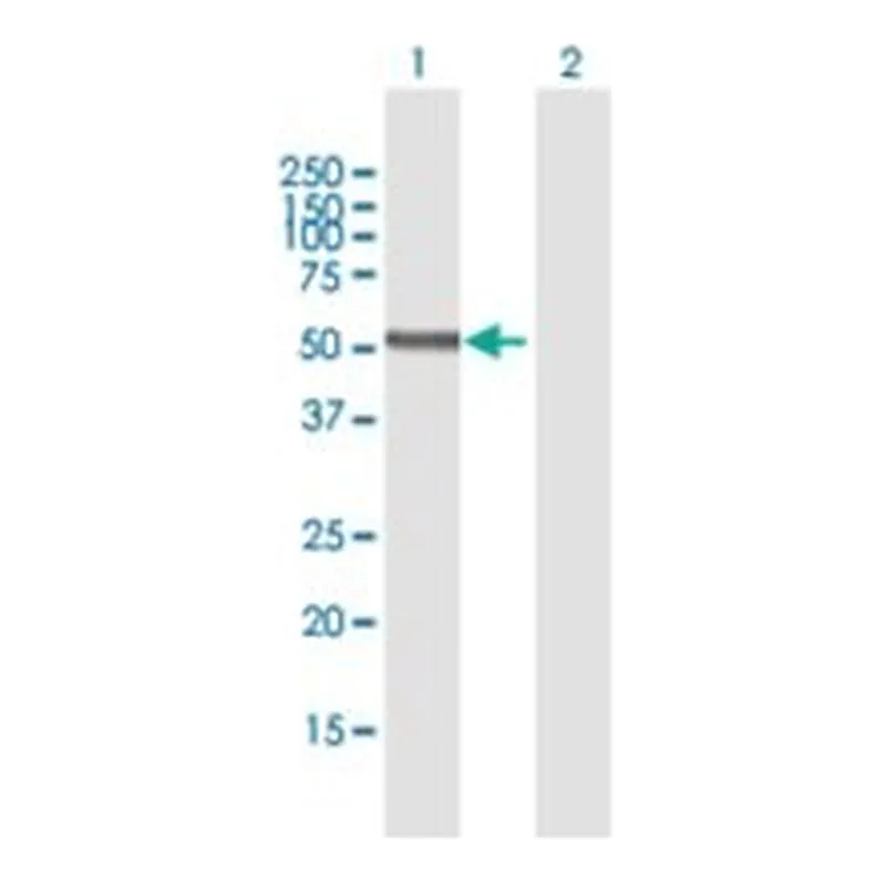 Merck ANTI-PNPLA3