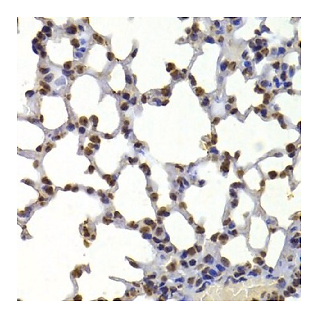 Merck Anti- HP1 alpha/CBX5 antibody produced in rabbit