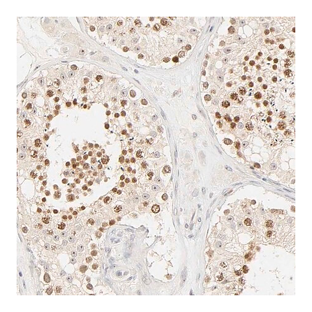 Merck Anti-KIF2A antibody produced in rabbit