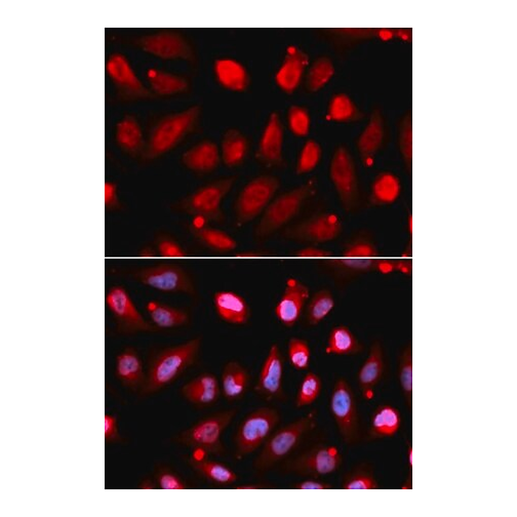 Merck Anti- EZH2/KMT6 antibody produced in rabbit