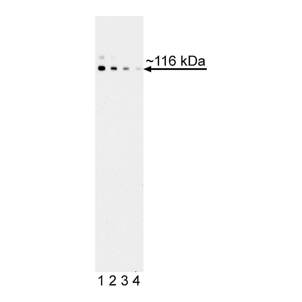 BD Purified Mouse Anti-Human LDLR