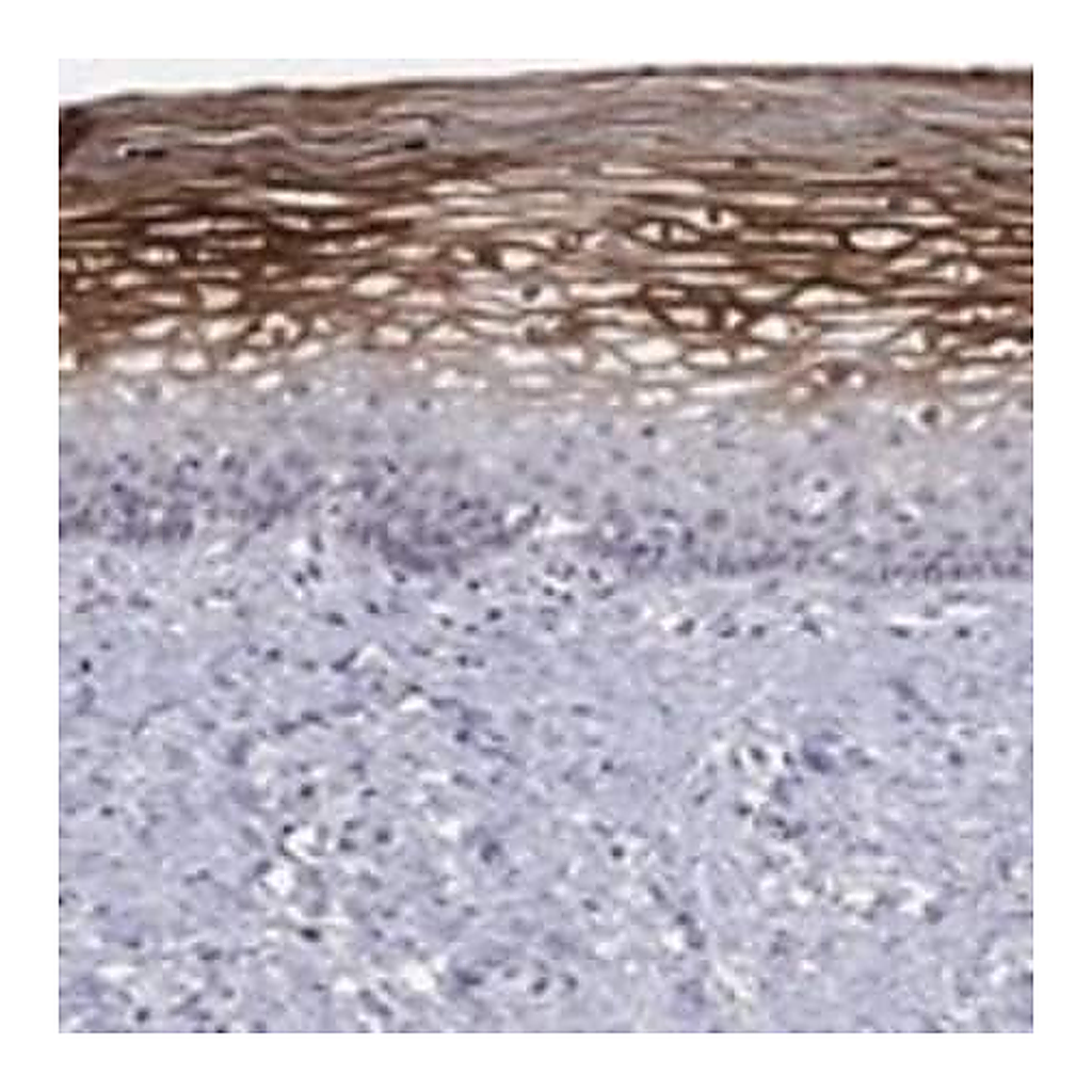 Merck Anti-ALOX12 antibody produced in rabbit