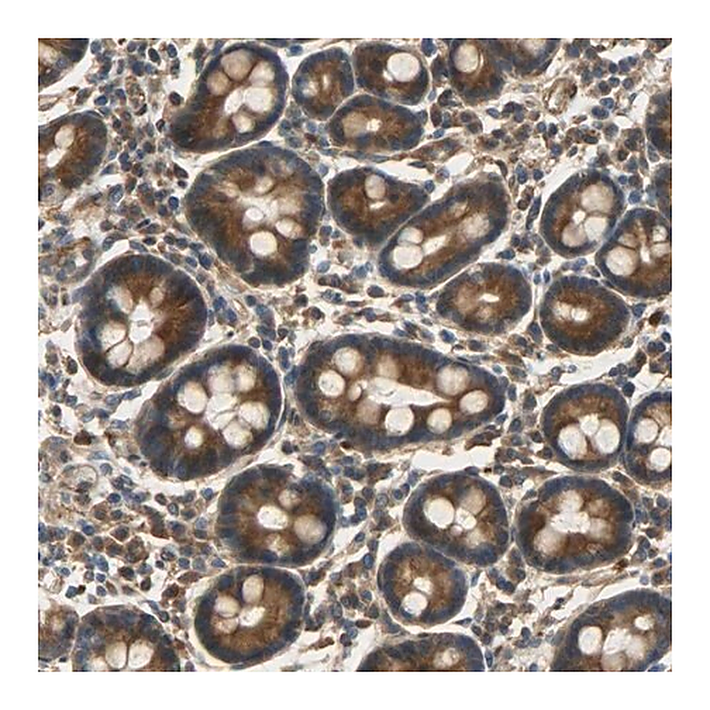 Merck Anti-C1orf198 antibody produced in rabbit