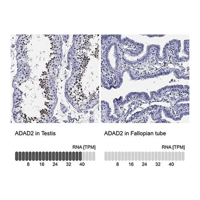Merck Anti-ADAD2 antibody produced in rabbit