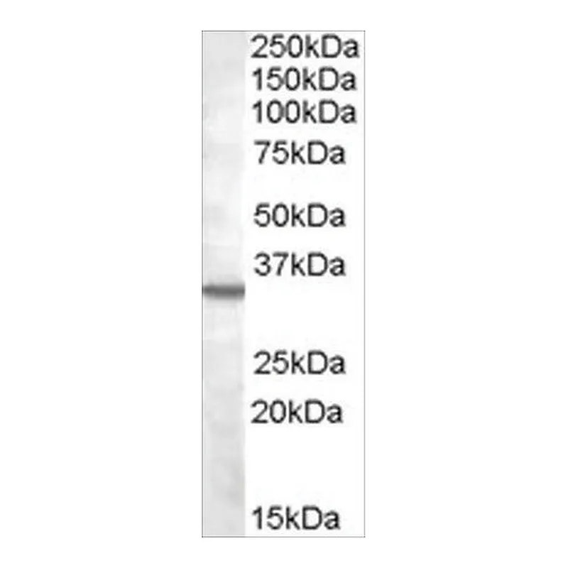 Merck Anti-Bradykinin Receptor B1 antibody produced in goat