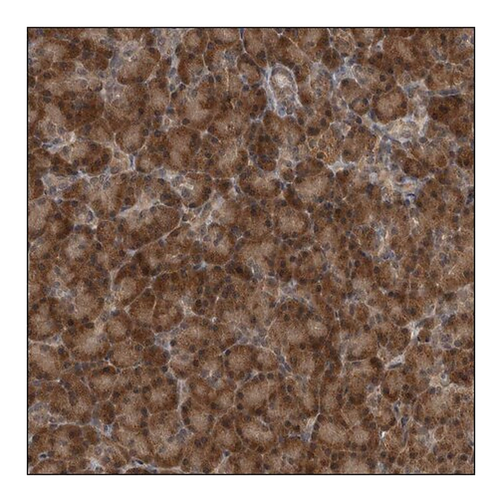 Merck ANTI-TTC25