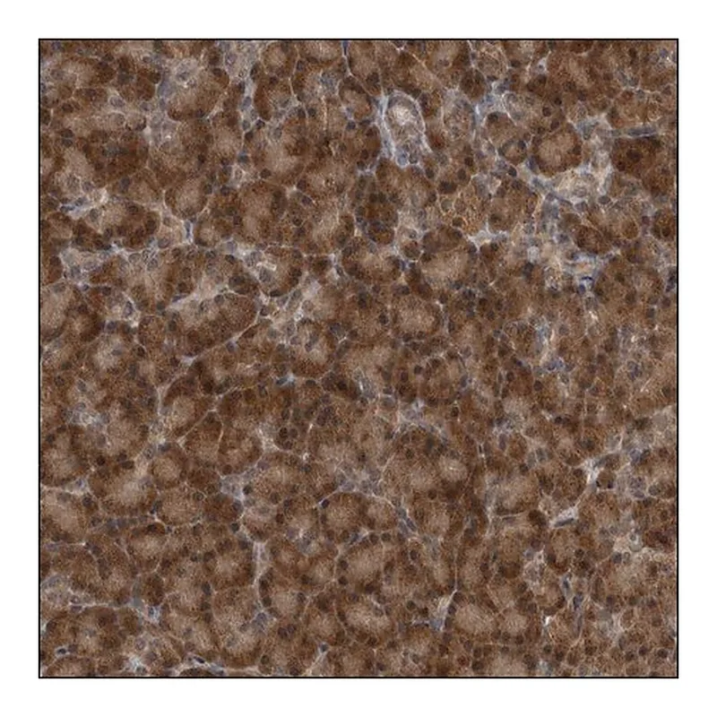 Merck ANTI-TTC25