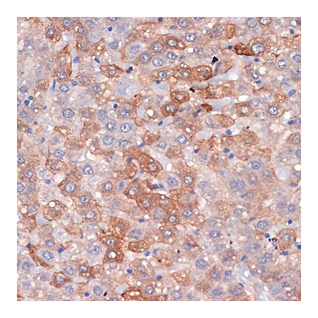 Merck Anti-Hemopexin (HPX) antibody produced in rabbit