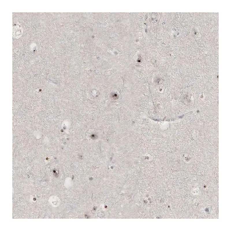 Merck Anti-DKC1 antibody produced in rabbit