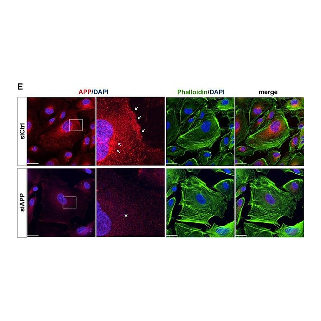Thermo Fisher Scientific Goat anti-Rabbit IgG (H+L) Cross-Adsorbed Secondary Antibody, Alexa Fluor 488