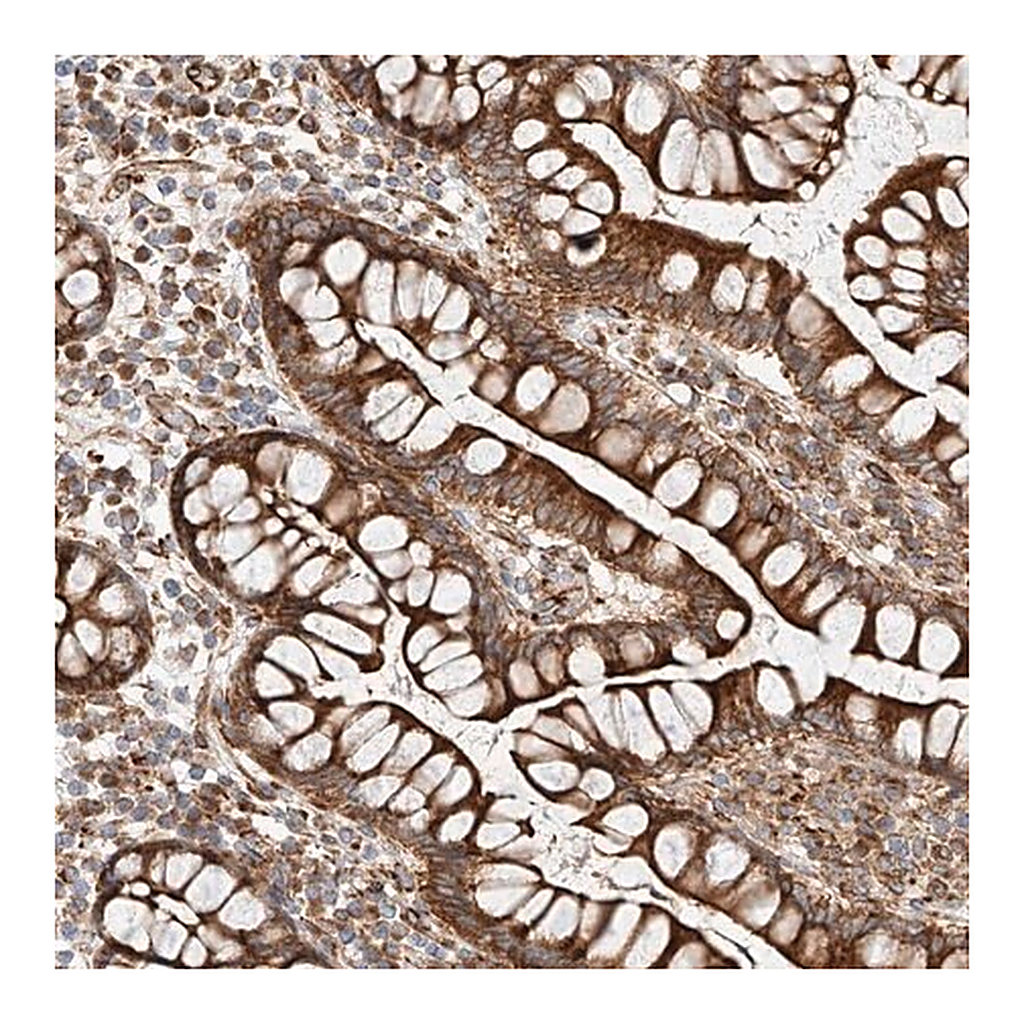 Merck Anti-CSGALNACT2 antibody produced in rabbit