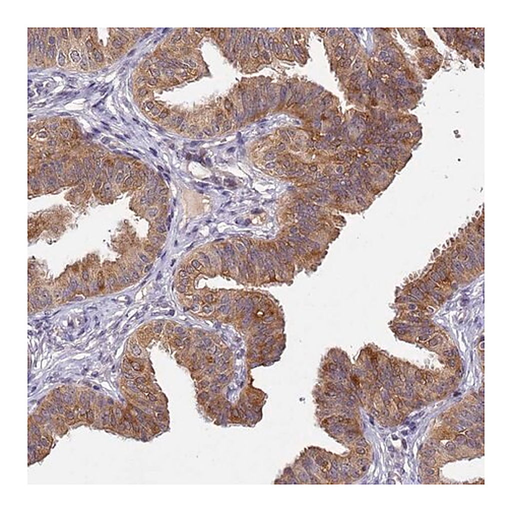 Merck Anti-TMEM39A antibody produced in rabbit