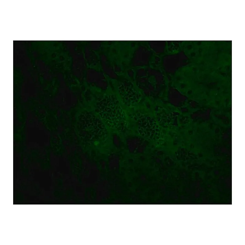 Merck Anti-Podoplanin (HG-19) antibody produced in rabbit
