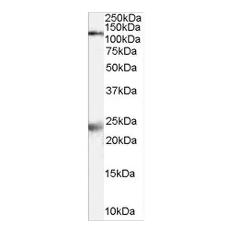 Merck Anti-NMDA Receptor 1/GRIN1 antibody produced in goat
