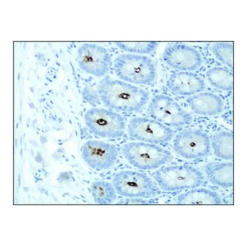 Merck ANTI-DSCR1 (C-TERMINAL)