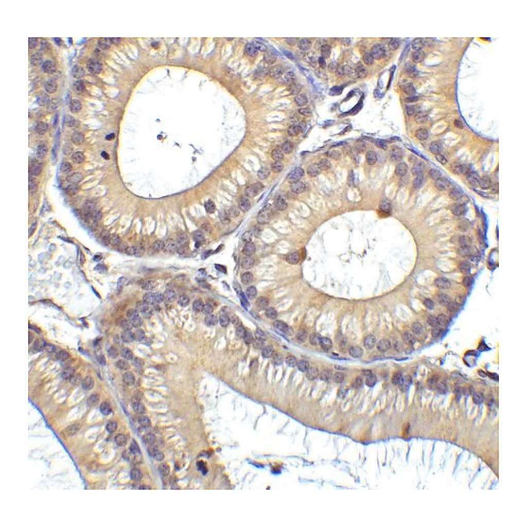 Merck Anti-RIG-1 antibody produced in rabbit