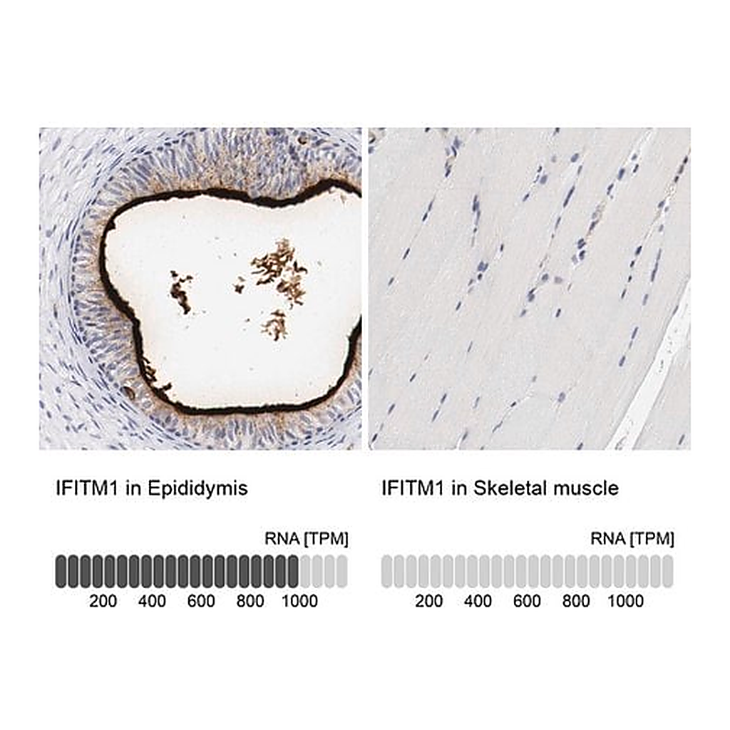 Merck Anti-IFITM1 antibody produced in rabbit