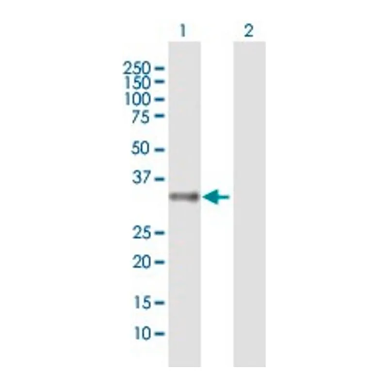 Merck Anti-MRGPRX2 antibody produced in mouse