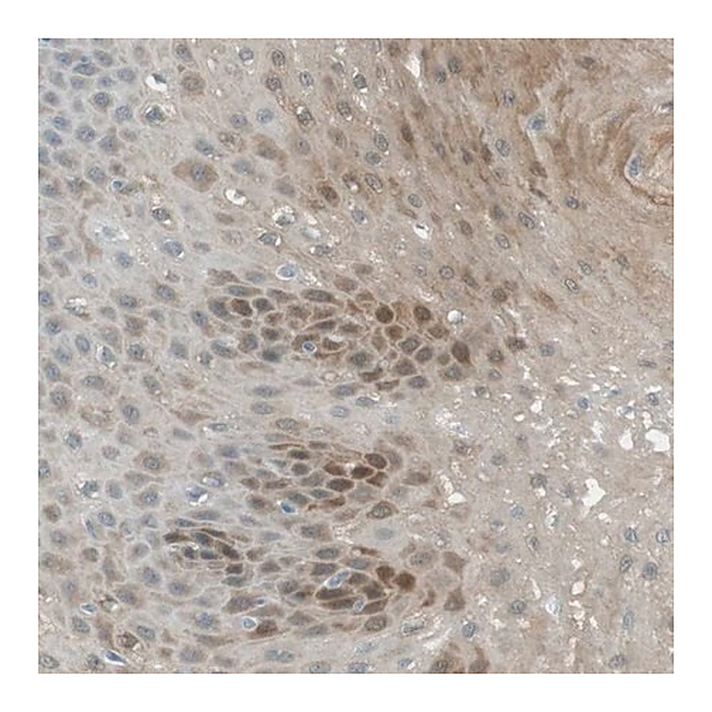 Merck Anti-SERPINB2 antibody produced in rabbit
