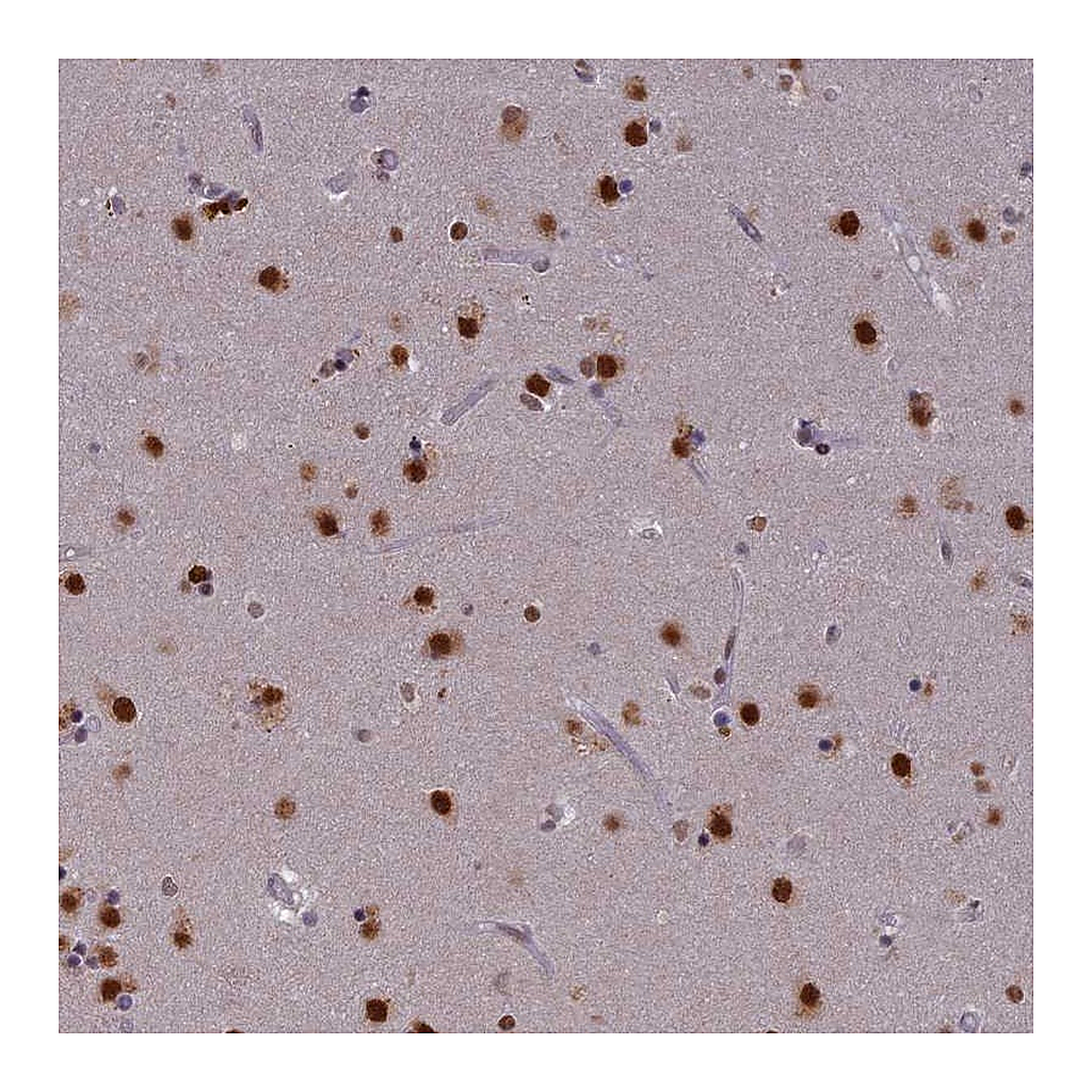 Atlas Antibodies Anti-SPIRE1 Antibody