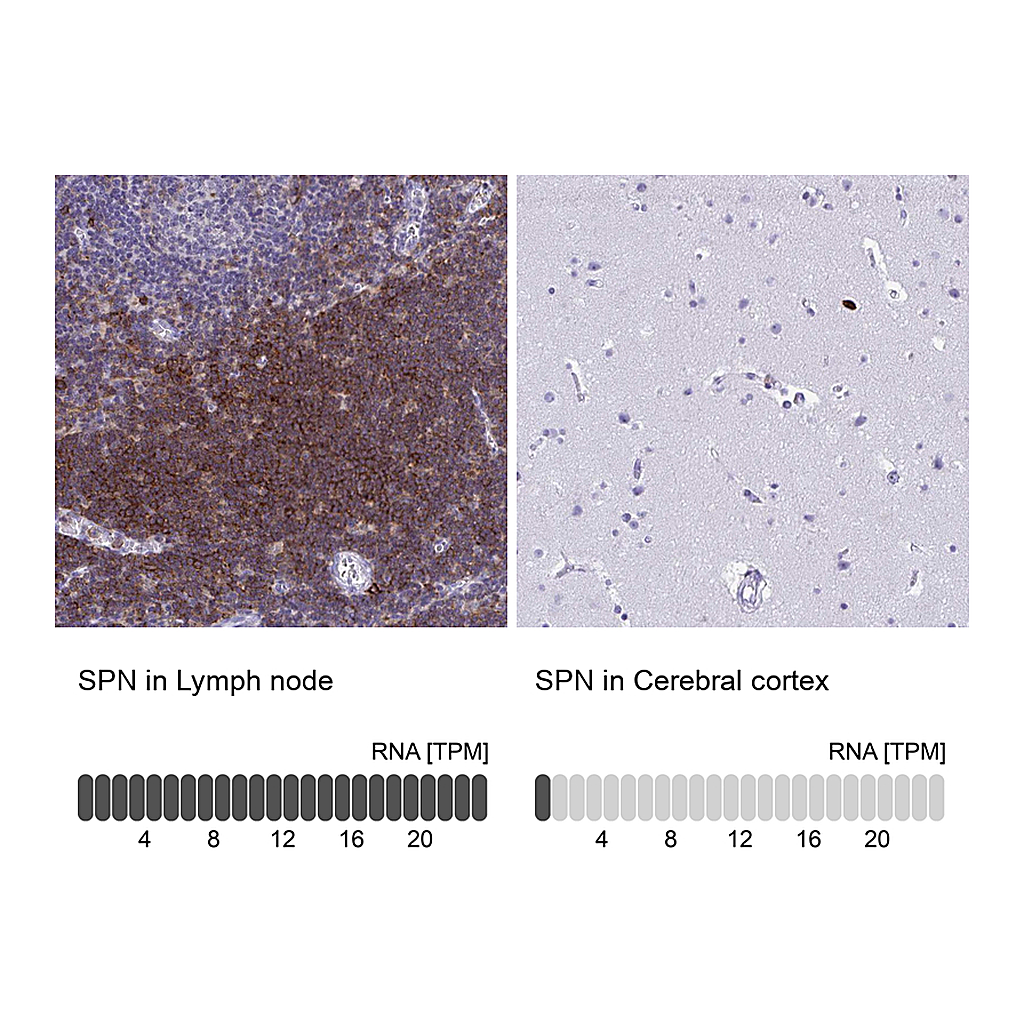 Atlas Antibodies Anti-SPN Antibody