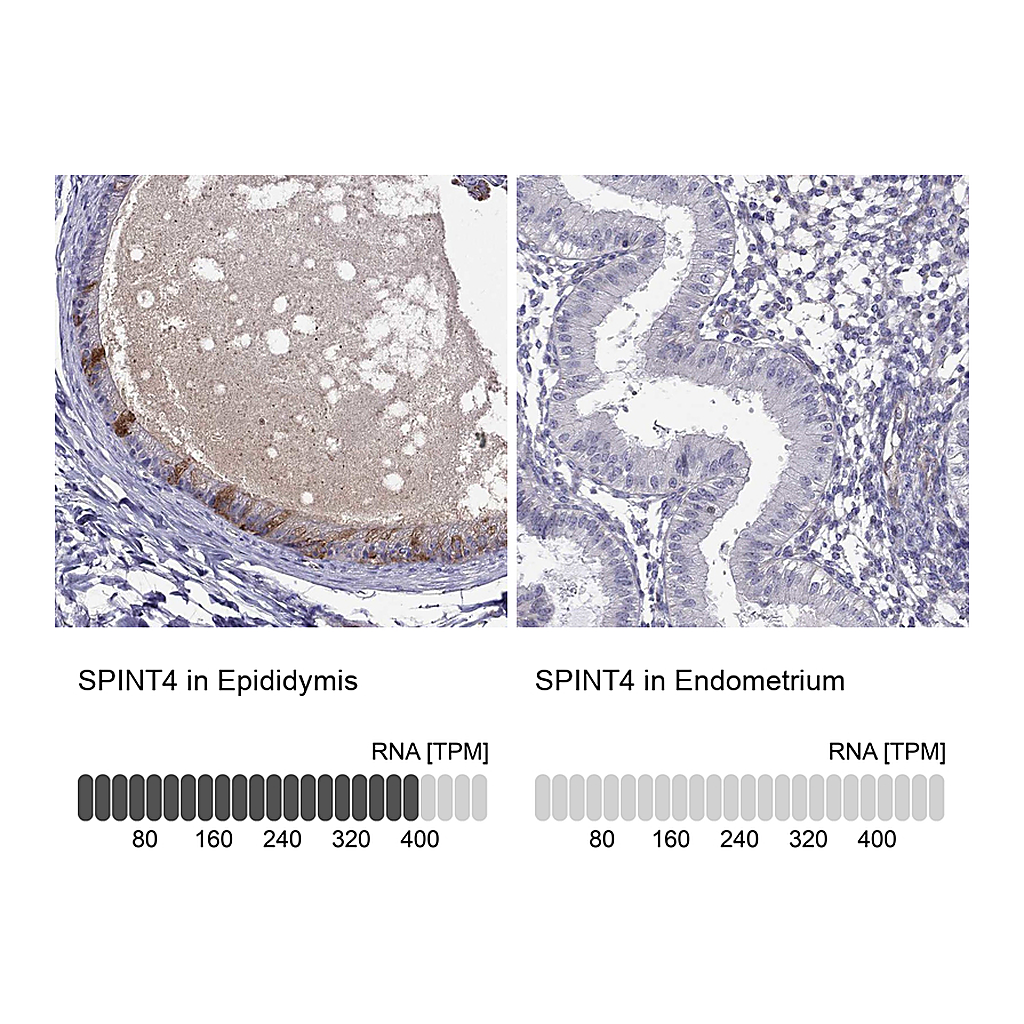 Atlas Antibodies Anti-SPINT4 Antibody
